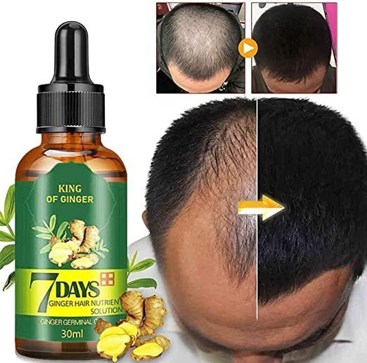 7 Days Hair Growth Oil thumbnail 6