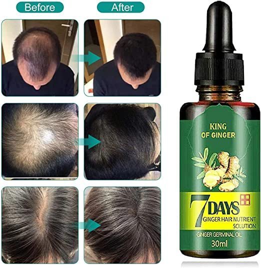 7 Days Hair Growth Oil thumbnail 7