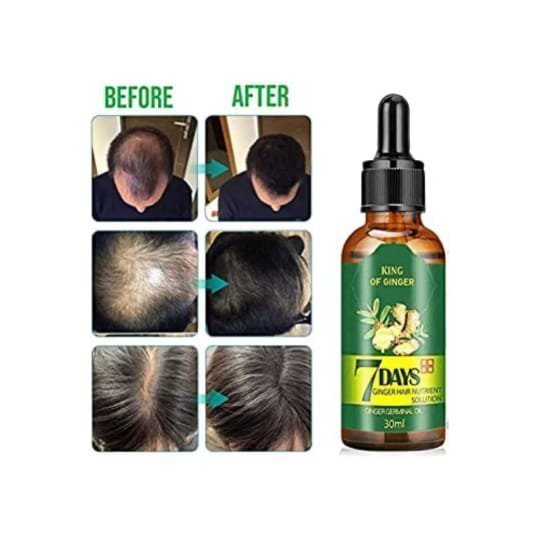7 Days Hair Growth Oil thumbnail 4