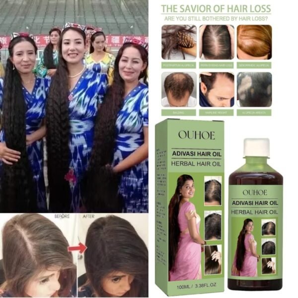 OUHOE Adivasi Hair Oil Herbal hair care for scalp cleansing hair loss prevention, and damage repair thumbnail 5