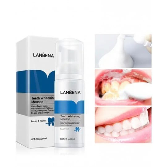 Lanbena Teeth Whitening Essence Liquid Cleaning Remove Stain Brighten Tooth